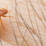 Bed bug treatment in the Mississippi gulf coast; Southern Pest Control